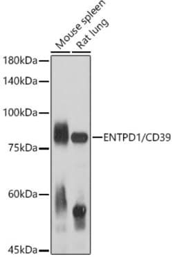 Invitrogen CD39 Polyclonal Antibody 100 &mu;L; Unconjugated:Antibodies,