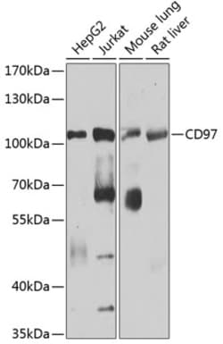 Invitrogen CD97 Polyclonal Antibody 100 &mu;L; Unconjugated:Antibodies,