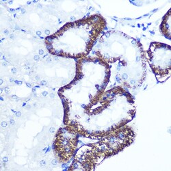 Invitrogen EXTL3 Polyclonal Antibody 100 &mu;L; Unconjugated:Antibodies,
