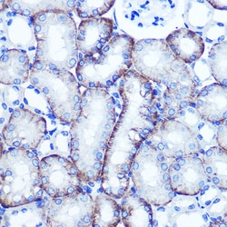 Invitrogen EXTL3 Polyclonal Antibody 100 &mu;L; Unconjugated:Antibodies,