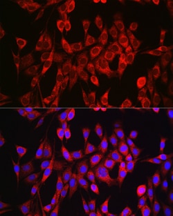 Invitrogen Glutaminase Polyclonal Antibody 100 &mu;L; Unconjugated:Antibodies,