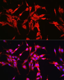 Invitrogen Glutaminase Polyclonal Antibody 100 &mu;L; Unconjugated:Antibodies,