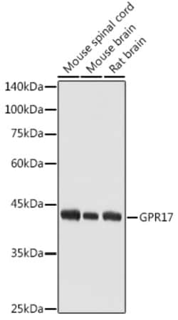 Invitrogen GPR17 Polyclonal Antibody 100 &mu;L; Unconjugated:Antibodies,