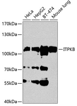 Invitrogen ITPKB Polyclonal Antibody 100 &mu;L; Unconjugated:Antibodies,
