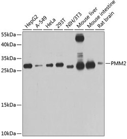 Invitrogen PMM2 Polyclonal Antibody 100 &mu;L; Unconjugated:Antibodies,