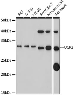 Invitrogen UCP2 Polyclonal Antibody 100 μL; Unconjugated:Antibodies,