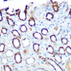 Invitrogen LONP1 Polyclonal Antibody 100 μL; Unconjugated:Antibodies,