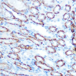 Invitrogen LONP1 Polyclonal Antibody 100 μL; Unconjugated:Antibodies,