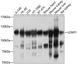 Invitrogen LONP1 Polyclonal Antibody 100 μL; Unconjugated:Antibodies,