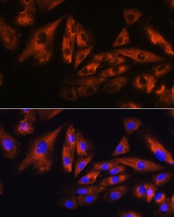 Invitrogen ATXN10 Polyclonal Antibody 100 μL; Unconjugated:Antibodies,