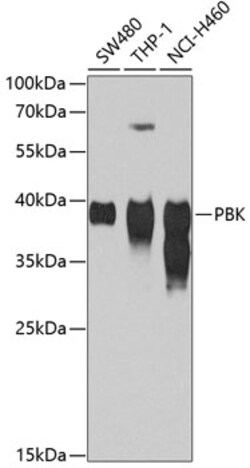 Invitrogen PBK Polyclonal Antibody 100 &mu;L; Unconjugated:Antibodies,