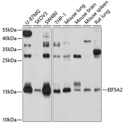 Invitrogen eIF5A2 Polyclonal Antibody 100 &mu;L; Unconjugated:Antibodies,