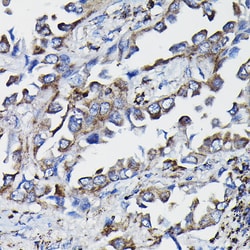 Invitrogen GSTK1 Polyclonal Antibody 100 &mu;L; Unconjugated:Antibodies,