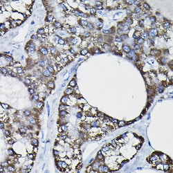 Invitrogen GSTK1 Polyclonal Antibody 100 &mu;L; Unconjugated:Antibodies,
