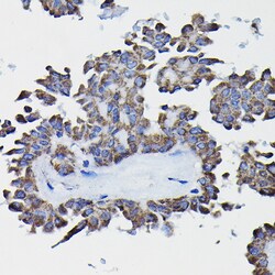 Invitrogen GSTK1 Polyclonal Antibody 100 &mu;L; Unconjugated:Antibodies,