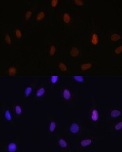 Invitrogen H3K14me1 Polyclonal Antibody 100 μL; Unconjugated:Antibodies,