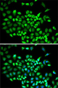 Invitrogen Cullin 2 Polyclonal Antibody 100 &mu;L; Unconjugated:Antibodies,