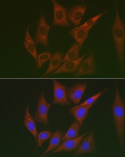 Invitrogen LUM Polyclonal Antibody 100 &mu;L; Unconjugated:Antibodies,