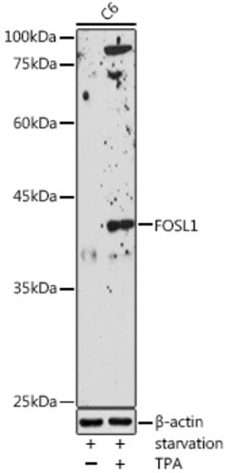 Invitrogen Fra1 Polyclonal Antibody 100 &mu;L; Unconjugated:Antibodies,