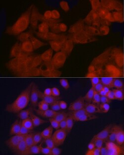 Invitrogen GFR alpha-1 Polyclonal Antibody 100 &mu;L; Unconjugated:Antibodies,