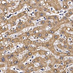 Invitrogen GFR alpha-1 Polyclonal Antibody 100 &mu;L; Unconjugated:Antibodies,