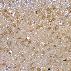 Invitrogen GFR alpha-1 Polyclonal Antibody 100 &mu;L; Unconjugated:Antibodies,