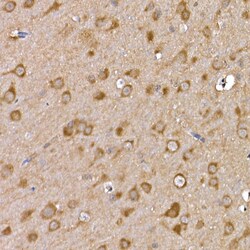 Invitrogen GFR alpha-1 Polyclonal Antibody 100 &mu;L; Unconjugated:Antibodies,