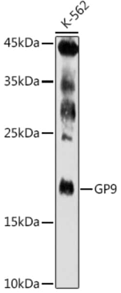 Invitrogen CD42a Polyclonal Antibody 100 &mu;L; Unconjugated:Antibodies,