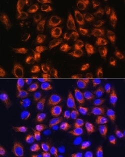 Invitrogen C7 Polyclonal Antibody 100 &mu;L; Unconjugated:Antibodies, Polyclonal