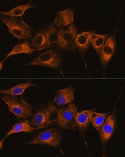Invitrogen C7 Polyclonal Antibody 100 &mu;L; Unconjugated:Antibodies, Polyclonal