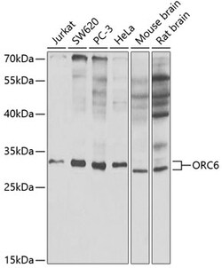 Invitrogen ORC6 Polyclonal Antibody 100 &mu;L; Unconjugated:Antibodies,