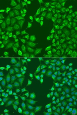 Invitrogen MERTK Polyclonal Antibody 100 &mu;L; Unconjugated:Antibodies,