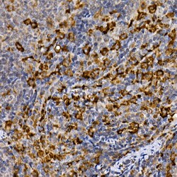 Invitrogen MERTK Polyclonal Antibody 100 &mu;L; Unconjugated:Antibodies,