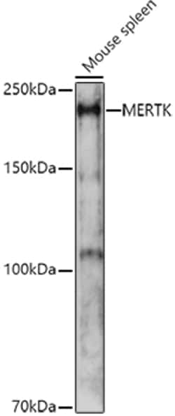 Invitrogen MERTK Polyclonal Antibody 100 &mu;L; Unconjugated:Antibodies,