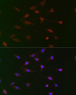 Invitrogen CDC34 Polyclonal Antibody 100 &mu;L; Unconjugated:Antibodies,