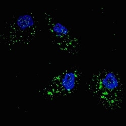 Invitrogen SQSTM1 Polyclonal Antibody 400 μL; Unconjugated:Antibodies,