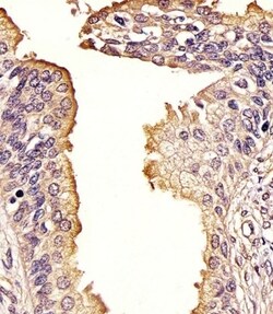Invitrogen SQSTM1 Polyclonal Antibody 400 μL; Unconjugated:Antibodies,