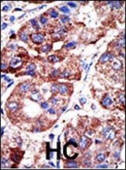 Invitrogen SQSTM1 Polyclonal Antibody 400 μL; Unconjugated:Antibodies,