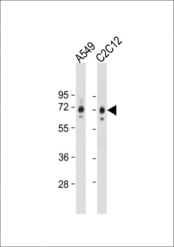 Invitrogen SQSTM1 Polyclonal Antibody 400 μL; Unconjugated:Antibodies,