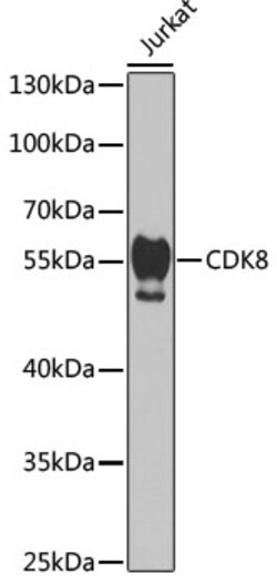 Invitrogen CDK8 Polyclonal Antibody 100 &mu;L | Buy Online | Invitrogen&trade; | Fisher Scientific