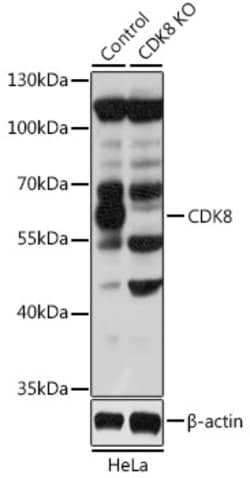 Invitrogen CDK8 Polyclonal Antibody 100 &mu;L | Buy Online | Invitrogen&trade; | Fisher Scientific