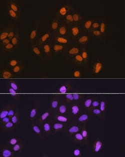Invitrogen MCM5 Polyclonal Antibody 100 &mu;L; Unconjugated:Antibodies,