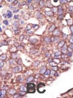 Invitrogen HRD1 Polyclonal Antibody 400 &mu;L; Unconjugated:Antibodies,