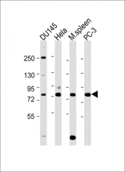 Invitrogen HRD1 Polyclonal Antibody 400 &mu;L; Unconjugated:Antibodies,