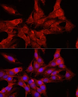Invitrogen DDX3 Polyclonal Antibody 100 &mu;L; Unconjugated:Antibodies,