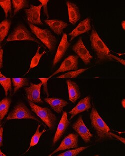Invitrogen DDX3 Polyclonal Antibody 100 &mu;L; Unconjugated:Antibodies,