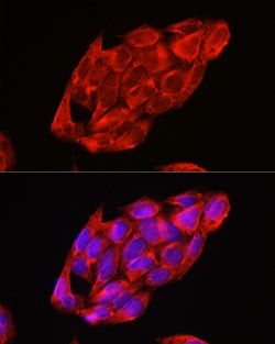 Invitrogen DDX3 Polyclonal Antibody 100 &mu;L; Unconjugated:Antibodies,