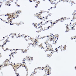 Invitrogen DDX3 Polyclonal Antibody 100 &mu;L; Unconjugated:Antibodies,