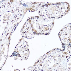Invitrogen DDX3 Polyclonal Antibody 100 &mu;L; Unconjugated:Antibodies,