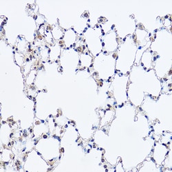 Invitrogen DDX3 Polyclonal Antibody 100 &mu;L; Unconjugated:Antibodies,